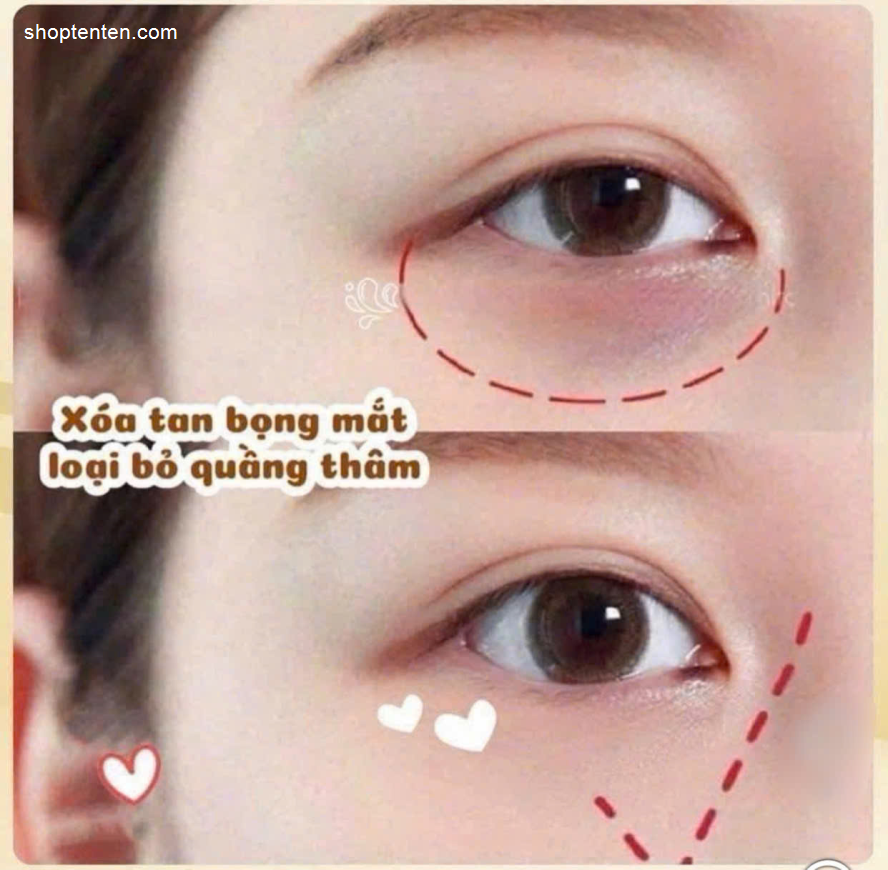 kem-mat-kem-duong-mat-estee-lauder-phap-giam-tham-bong-mat-mini-5ml-7799