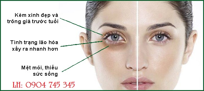 kem-mat-kem-duong-am-tri-quang-tham-vung-mat-ladamer-intensive-vitalizing-eye-cream-3342