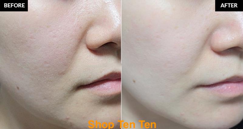 kem-duong-trang-da-kem-duong-trang-c20-tiam-acream-han-quoc-50ml-5494