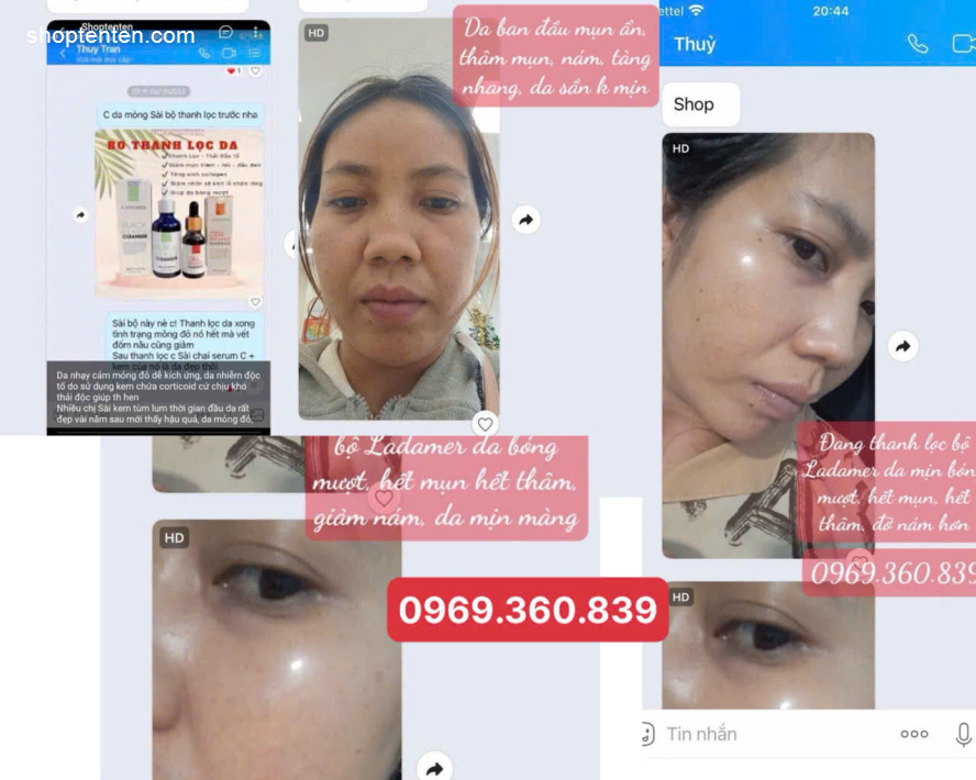 tri-mun-serum-mun-giam-nhon-ladamer-black-head-x-cleanser-han-quoc-7804